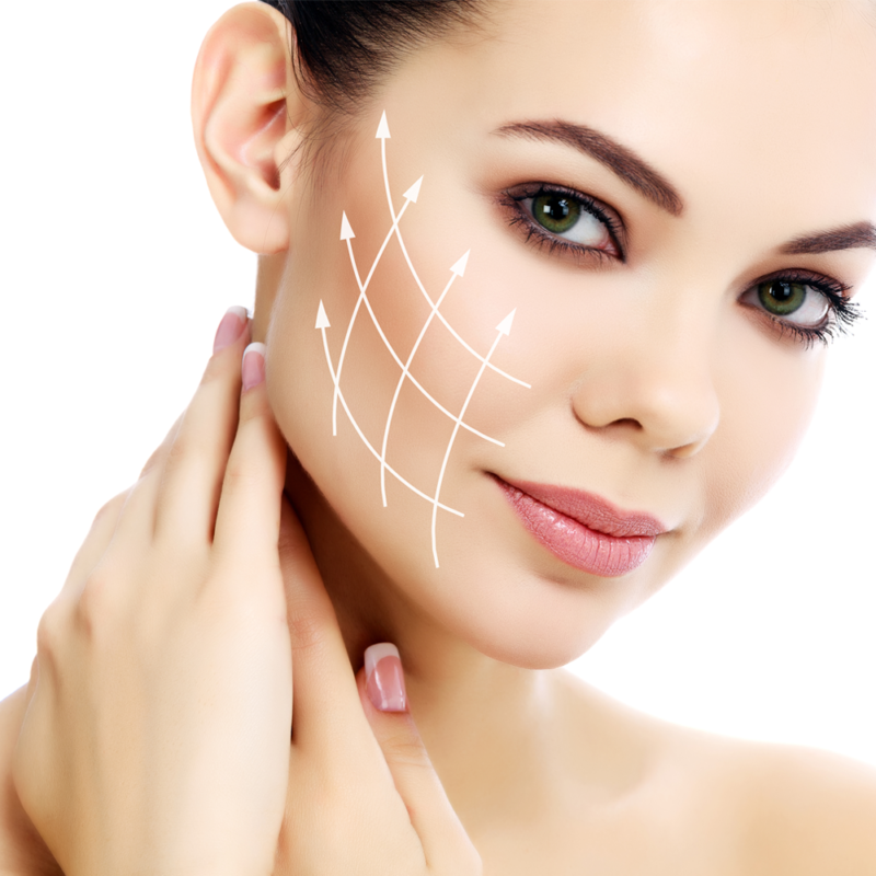 Fadenlifting | Naturheilpraxis Schmerz-Koerpertherapie, Gerlingen